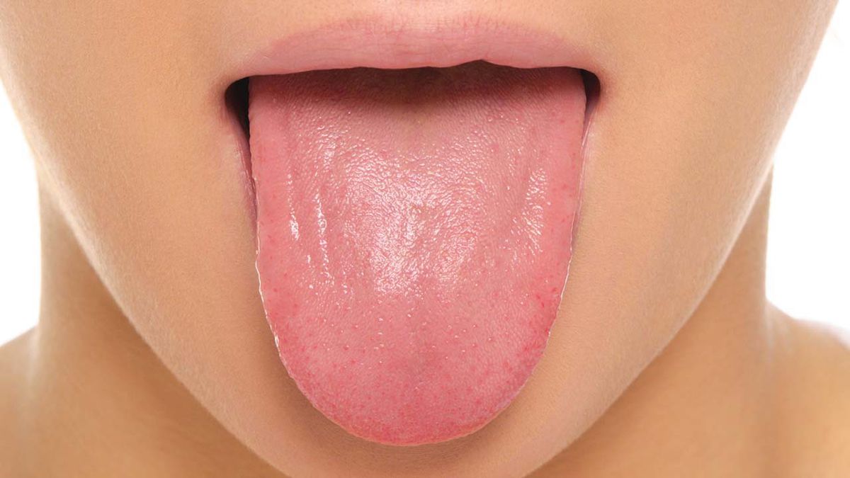 tongue_oral_cancer