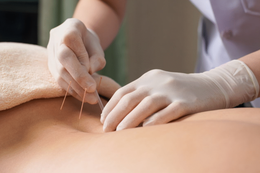 Acupuncture During Chemo: A Safe Alternative?